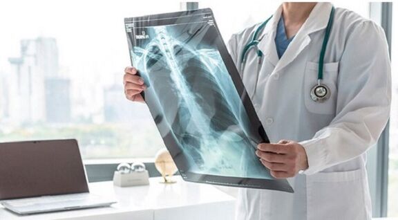 Rentgenová diagnostika bolesti pod levou lopatkou