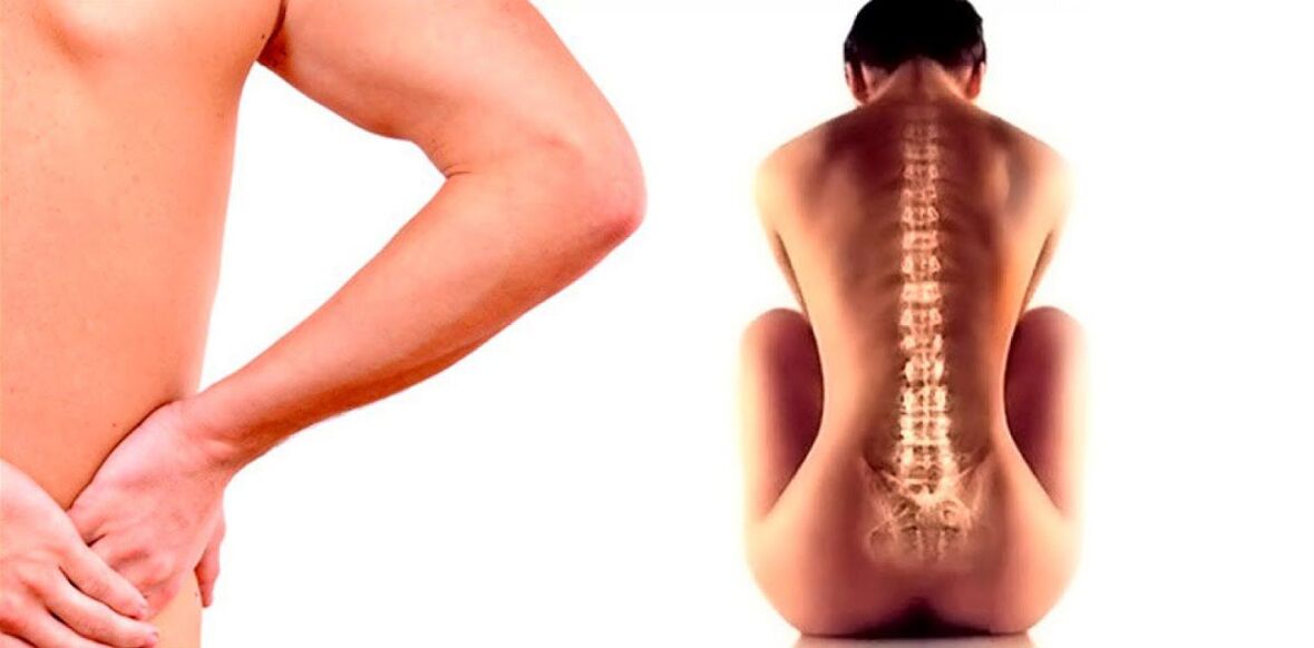 bolest dolní části zad způsobená osteochondrózou