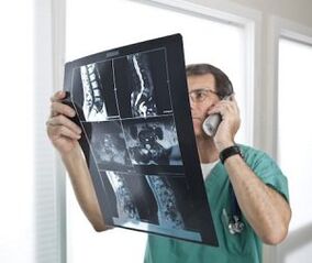 Myelografie pro diagnostiku osteochondrózy a intervertebrálních kýl