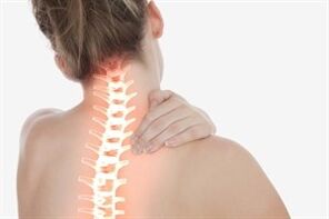 Cervikální osteochondróza u ženy